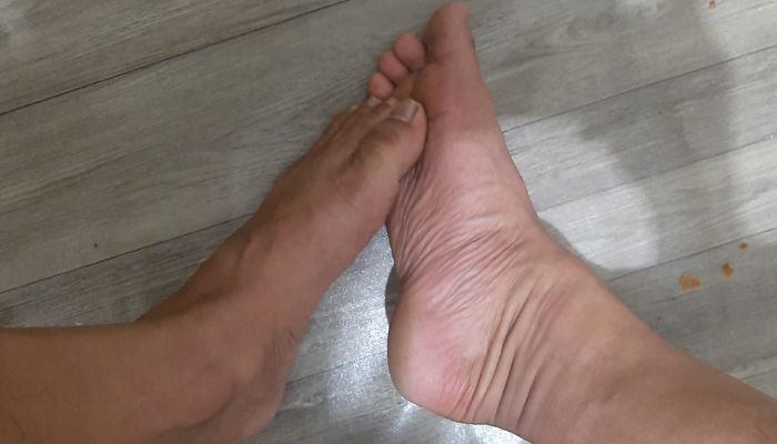 PENTING! Baca Sebelum Terlambat, 4 Tanda di Kaki Ini Bisa Jadi Gejala Gangguan Kesehatan Paru-paru