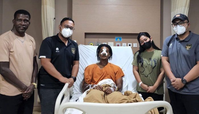 Ronaldo Kwateh Segera Gabung Madura United, Operasi Hidungnya Berjalan Lancar