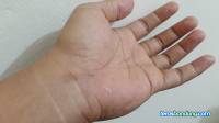 4 Tip Mengatasi Kulit Kering, Bisa Dilakukan Sendiri di Rumah