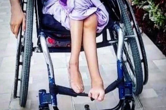 Dinkes Kota Bandung Jelaskan Penyebab Polio Mendadak pada Anak, Segera Lapor ke Puskesmas Jika Ada Kasus Serupa